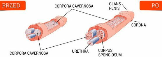 Benefícios, métodos de uso e efeitos colaterais de erogan